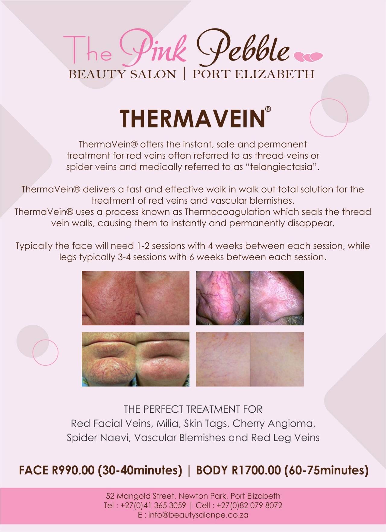 Thermavein-advert-28-july-2021